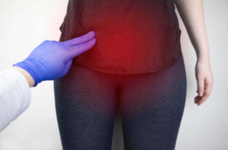 Vaginismo, imagem ilustra uma mulher com o assoalho pélvico destacada e um fisioterapeuta indicando onde pode haver dor