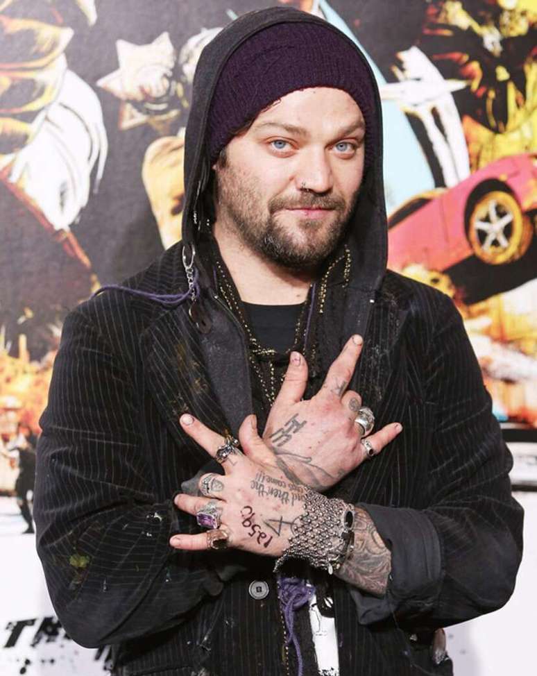 ‘Jackass’ star to wear alcohol-detector anklet after arrest