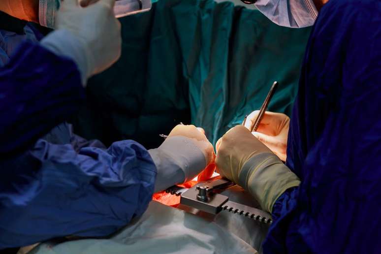 Durante a cirurgia de transplante, o paciente sobrevive com um coração artificial (Imagem: Twenty20photos/Envato)