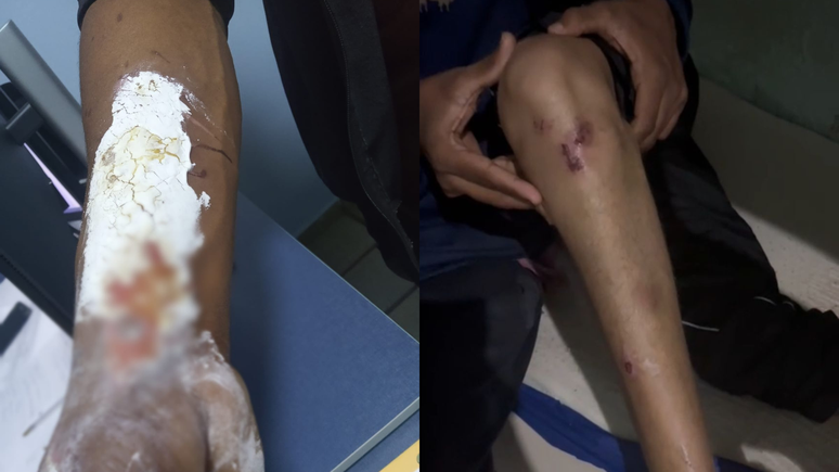 Pol&iacute;cia resgata 50 pessoas de c&aacute;rcere e tortura em cl&iacute;nica clandestina em GO