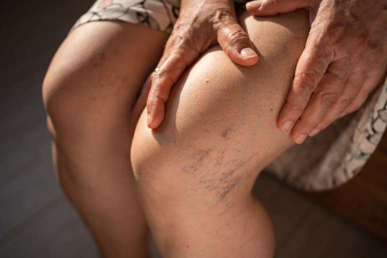 How to prevent vascular disease: the doctor lists 6 important tips