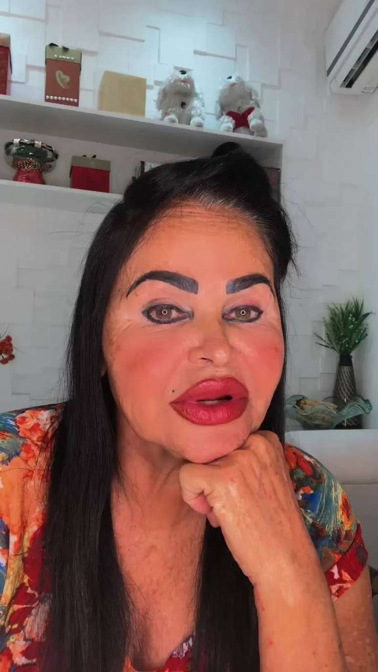 Singer Eduardo Costa’s mother draws attention to her appearance, but denies plastic surgery
