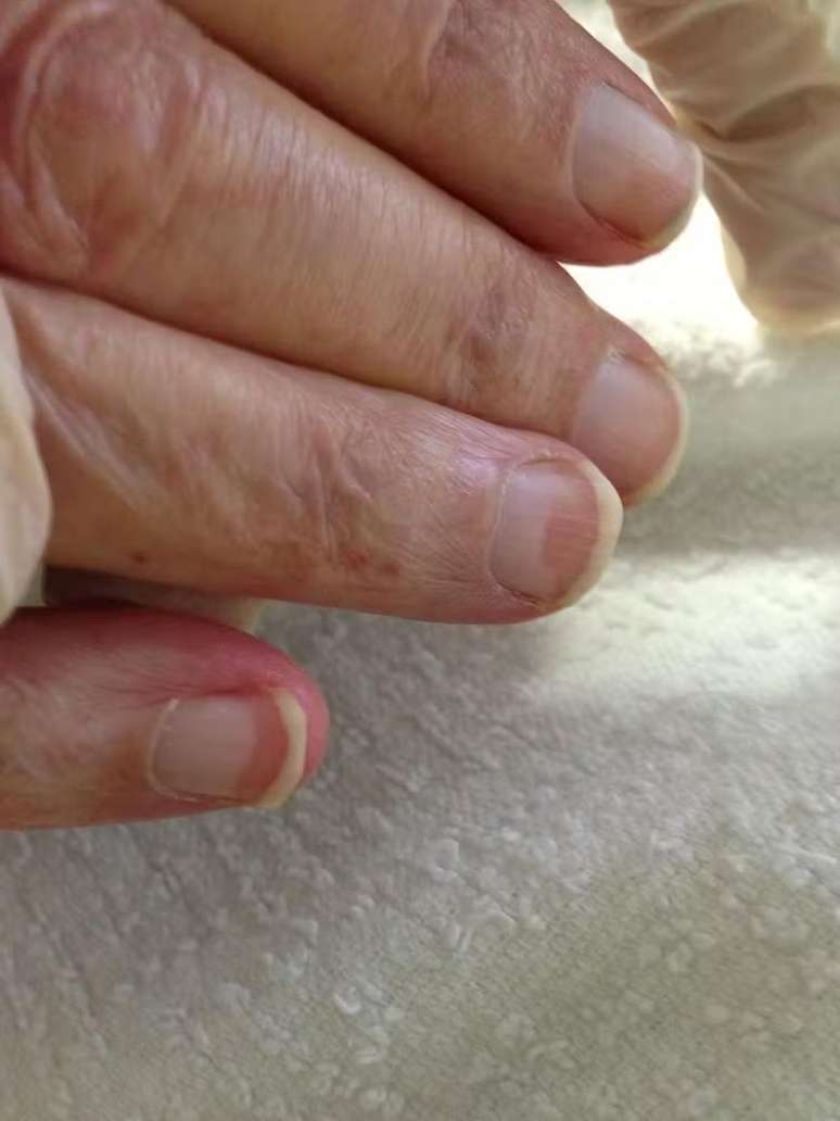 Terry's nails typically have a frosted glass appearance.