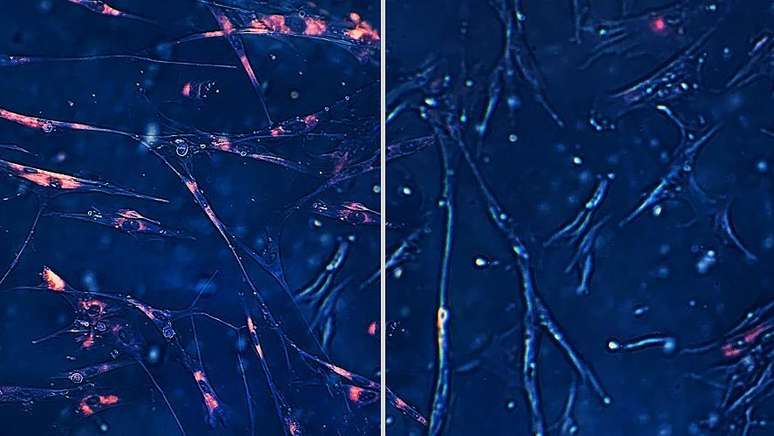 Senolytics are able to eliminate aged, senescent cells