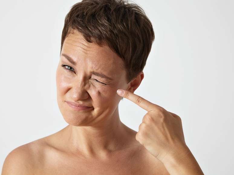 Expression lines and wrinkles are not the same thing: understand the difference