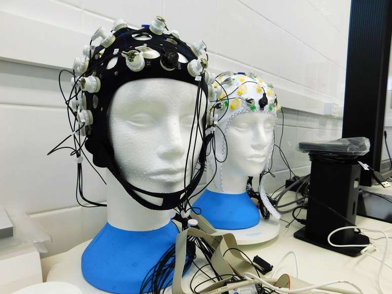 L'EEG prende l'attività cerebrale sotto forma di grafico e ci permette di vedere quali onde cerebrali emette un individuo (Immagine: Sturm/CC-BY-4.0)
