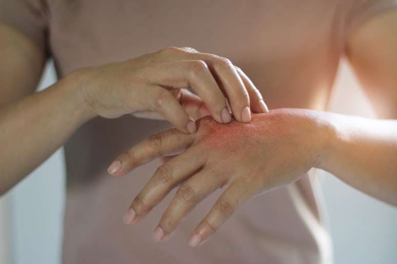 9 tips for those with sensitive skin