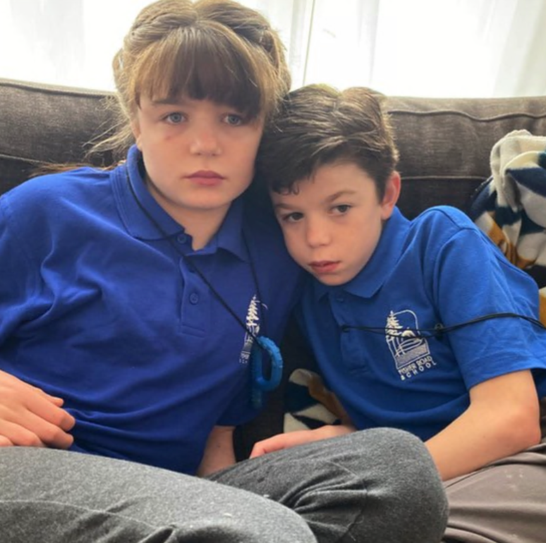 A s&iacute;ndrome de Sanfilippo &eacute; uma doen&ccedil;a gen&eacute;tica rara em que uma altera&ccedil;&atilde;o em um &uacute;nico gene torna o corpo de uma crian&ccedil;a incapaz de decompor certos carboidratos (a&ccedil;&uacute;cares)