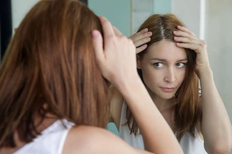 Cabelos ralos e finos são sintomas comuns na parte superior da cabeça de mulheres 