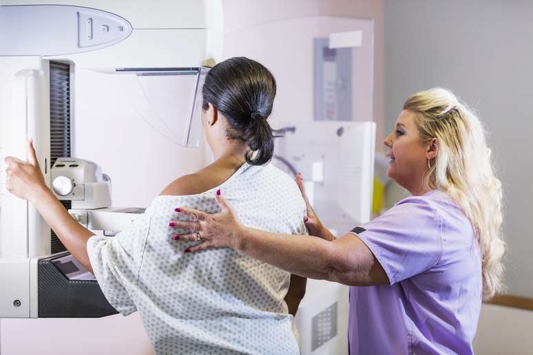 A mamografia é um exame de imagem para obter imagens detalhadas das mamas