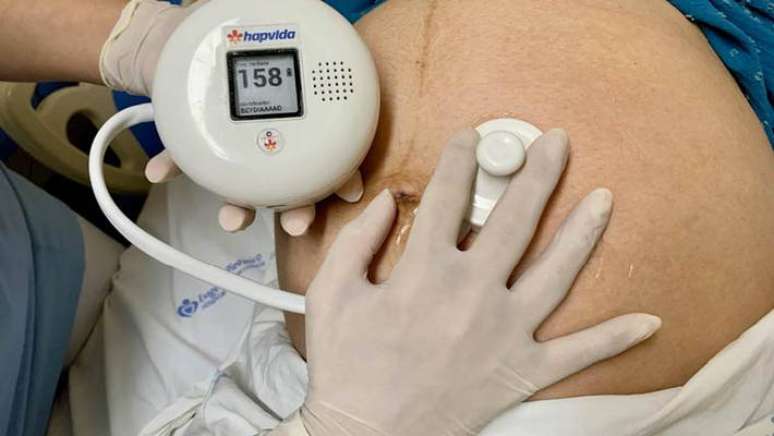 Inova&ccedil;&otilde;es como o aparelho pr&oacute;prio de monitoramento do batimento cardiofetal t&ecirc;m contribu&iacute;do para partos seguros