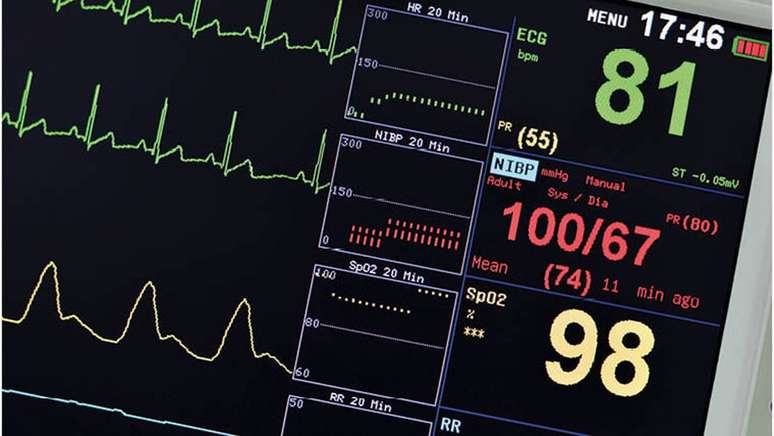 Novo sistema de eletrocardiograma da empresa tem evitado falha na interpreta&ccedil;&atilde;o do exame