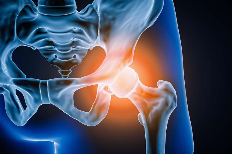 Discover the myths and truths about osteoarthritis