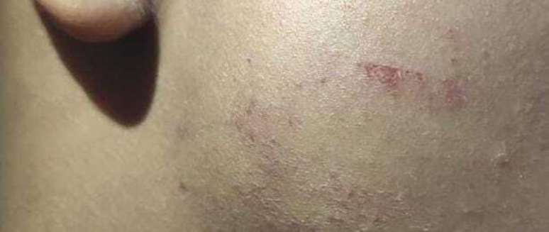 Imagem mostra rosto de criança com hematomas