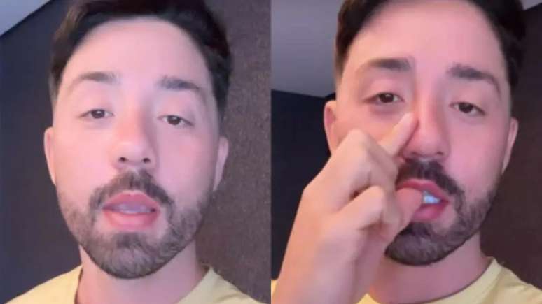 After revealing facial paralysis, Rico Melquiades undergoes surgery