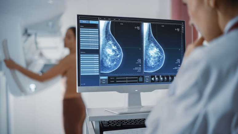 A mamografia é essencial no combate ao câncer de mama -