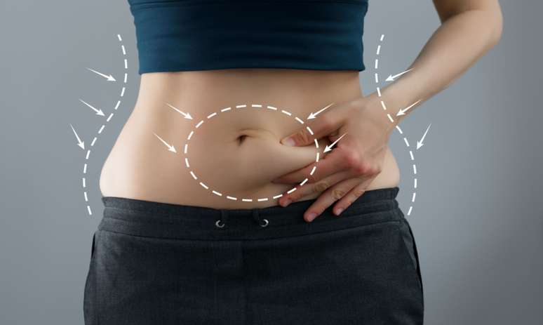 Abdominoplastia: entenda as diferentes finalidades do procedimento -