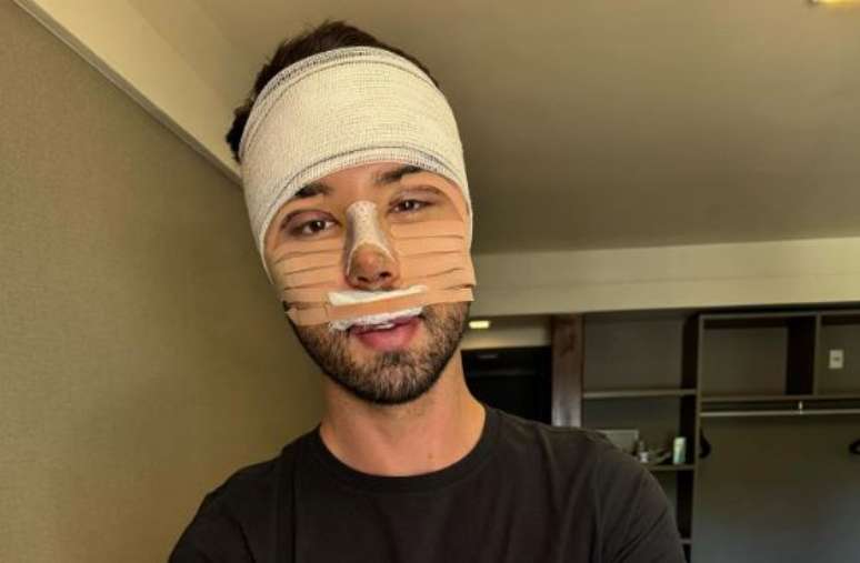 Rico vents after facial surgery: “I couldn’t stand being called ugly anymore”