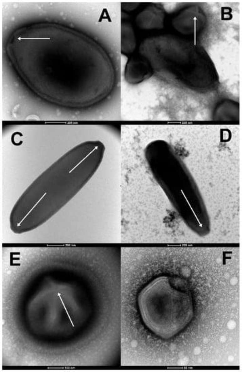 A. Pandoravirus yedoma; B. Pandoravirus mammoth; C. Cedratvirus lena; D. Pithovirus mammoth; E. Megavirus mammoth; F. Pacmanvirus lupus.