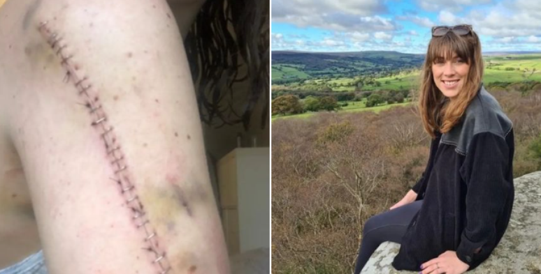 A woman undergoes cancer treatment for two years and discovers she never had the disease