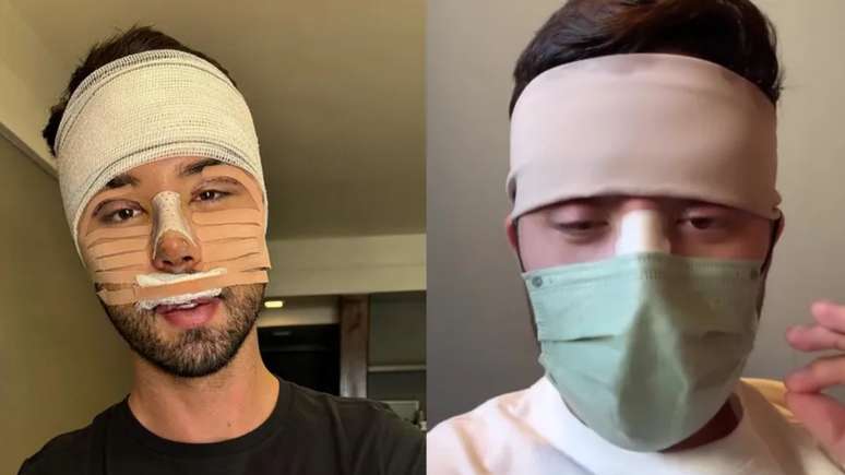 Rico Melquiades reveals shocking addiction after attacks due to his appearance