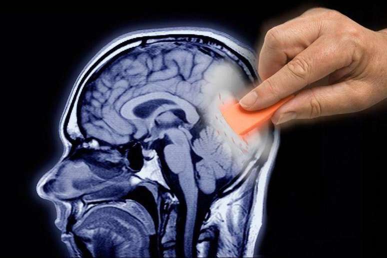 Can we introduce and erase a person's memories? Can we introduce and erase a person's memories?