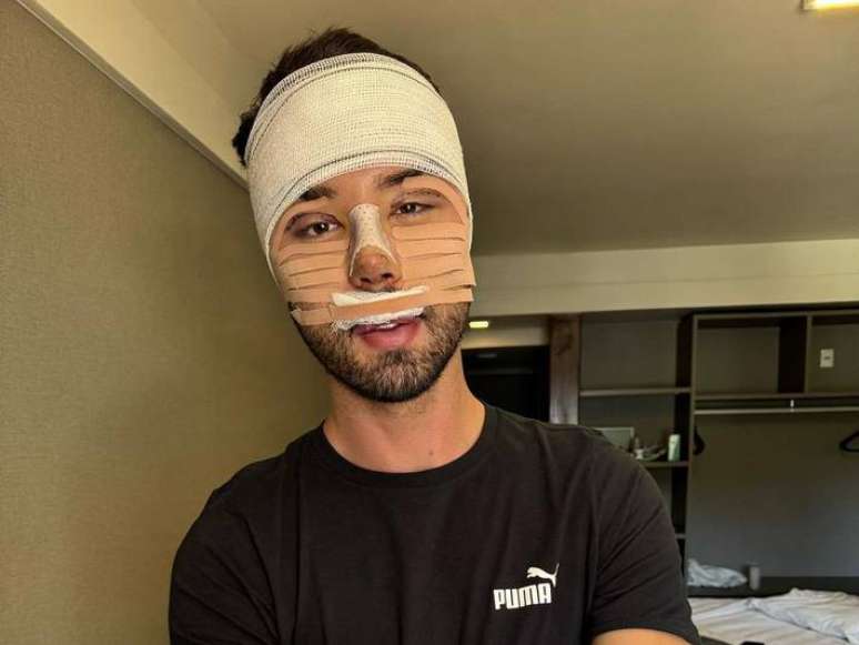 Rico Melqu&iacute;ades mostrou resultado de cirurgias pl&aacute;sticas que realizou no rosto e custaram R$ 50 mil.