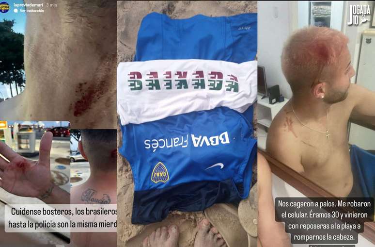 Argentinos mostraram agressões em redes sociais –