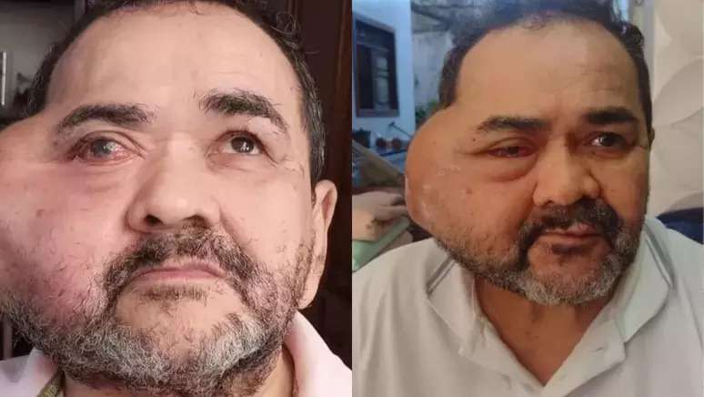 José Nilton Cardozo, de 65 anos, tinha sido internado na segunda-feira, 30, após tumor voltar a crescer. 