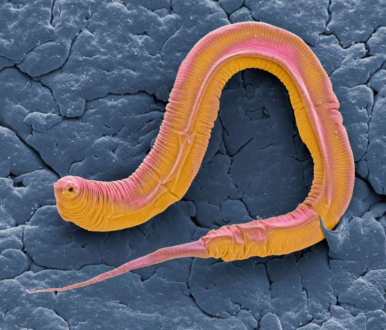 O Caenorhabditis elegans é frequentemente utilizado para estudos relacionados ao envelhecimento