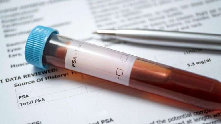 O PSA é uma enzima que pode ser medida pelo sangue e ajuda a entender se há algo de errado na próstata