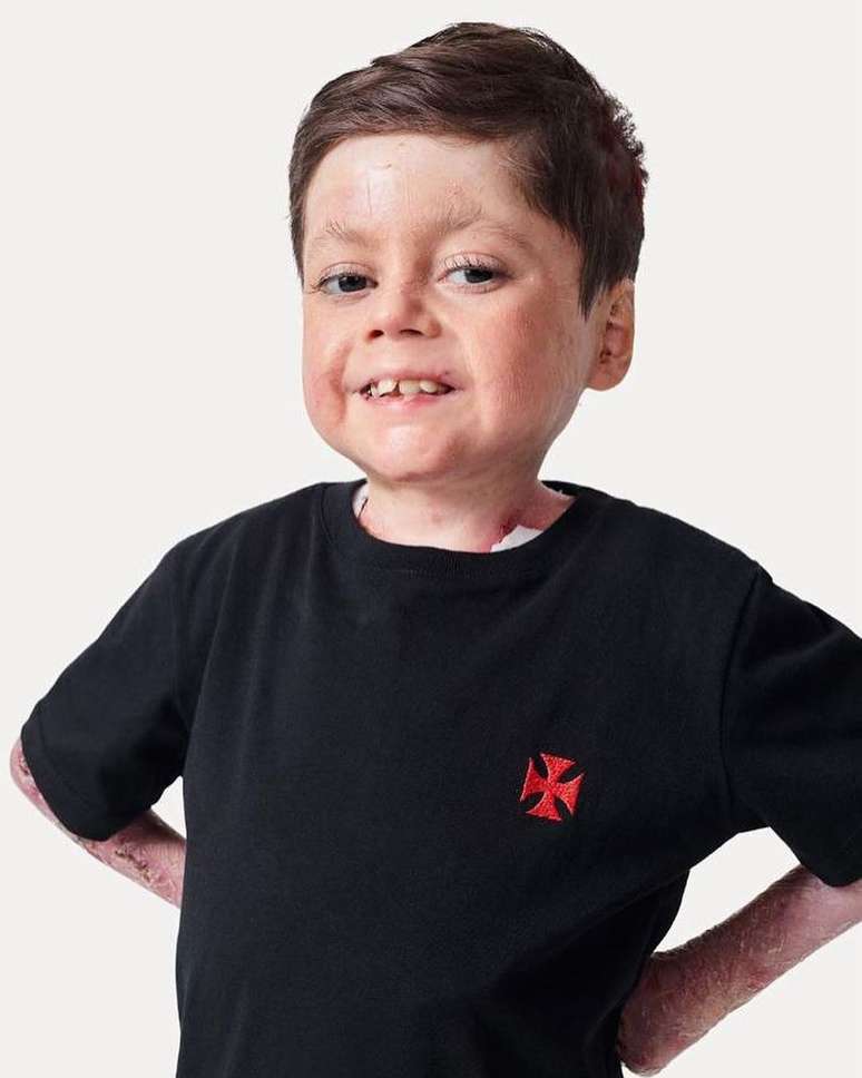 O pequeno Gui já estreou campanhas publicitárias