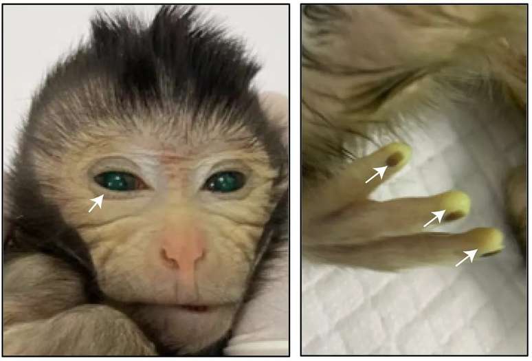 É o primeiro nascimento vivo de uma quimera de primata criada com células-tronco, disseram os pesquisadores.