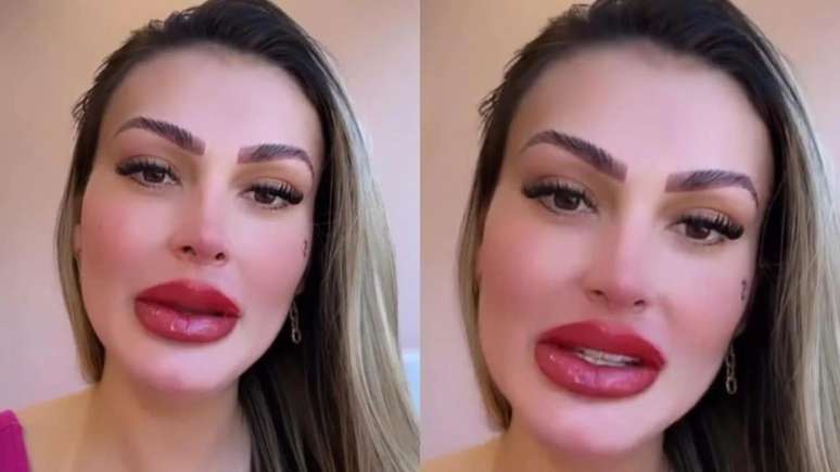 Andressa Urach appears with swollen lips after having her mouth “tattooed”.
