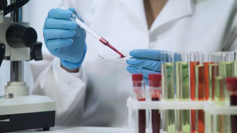 I took the HIV test 33 days after the suspected affair;  do I have to repeat?