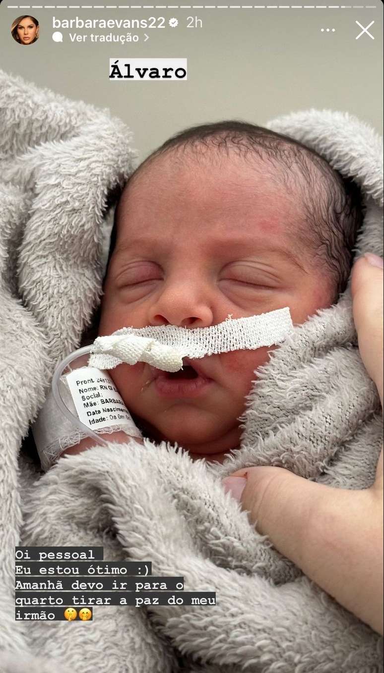 Bárbara Evans exibe rosto de Álvaro.