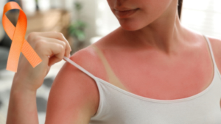 Dezembro Laranja época de sol, praia, piscina e prevenção ao câncer de pele!