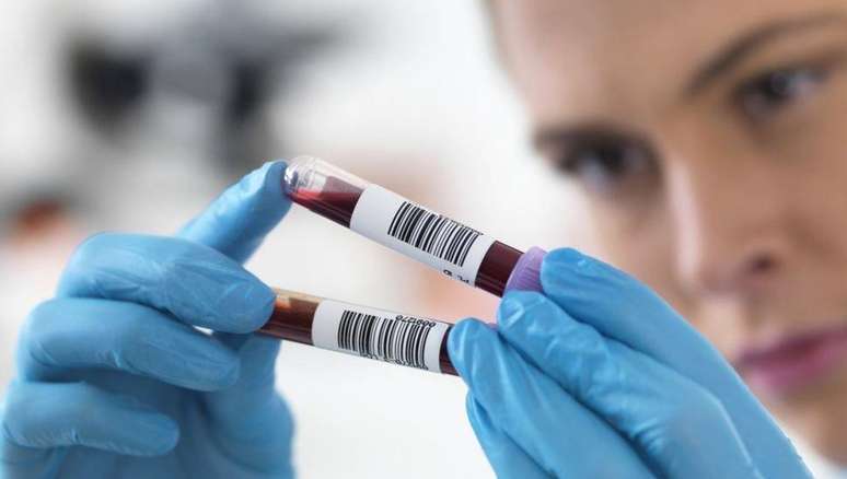 Pesquisadora segurando amostras de sangue