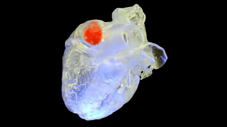 Scientists use ultrasound to 3D print inside the human body