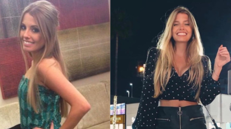 The Globo presenter remembers the accident in which she lost a leg 9 years ago: “Present”