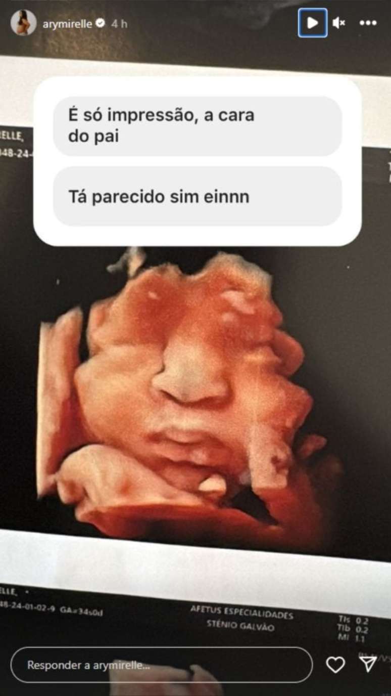 Story de Ary Mirelle - Reprodu&ccedil;&atilde;o/Instagram