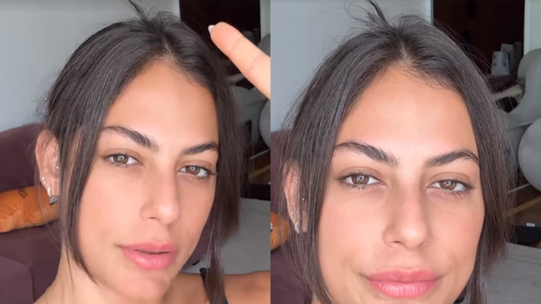 Mari Gonzalez mostra cabelo danificado após acidente com babyliss