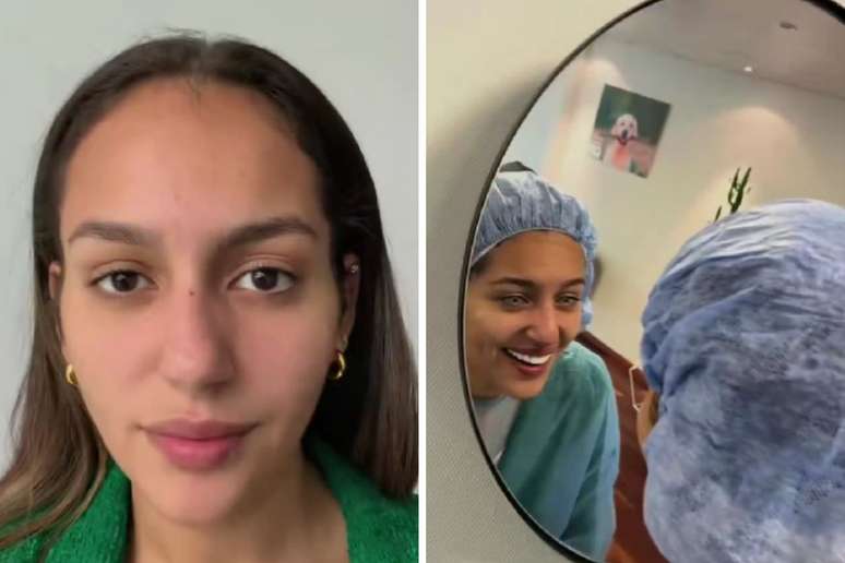 Jovem brasileira troca a cor dos olhos em cirurgia. Saiba os riscos. |