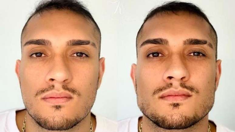 Mc Bin Laden mostra antes e depois de hamornização facial