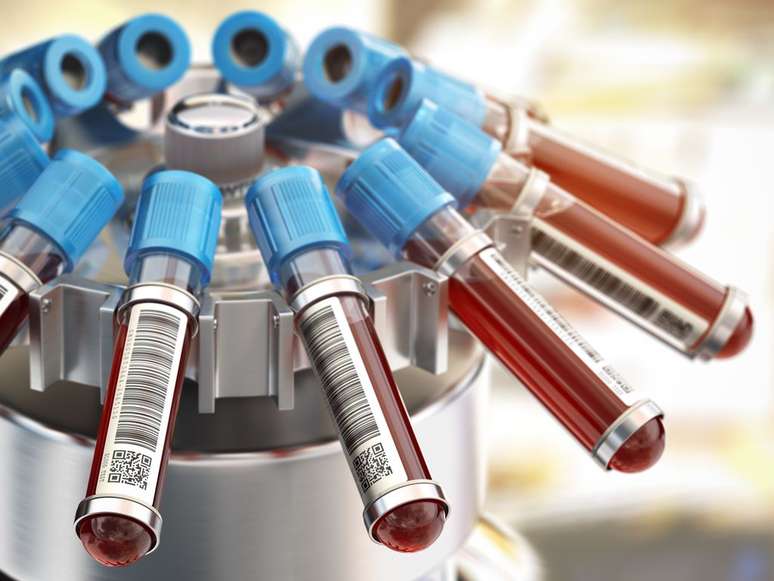 Cientistas desenvolvem exame de sangue capaz de rastrear 18 diferentes tipos de câncer no estágio inicial (Imagem: Maxxyustas/Envato)