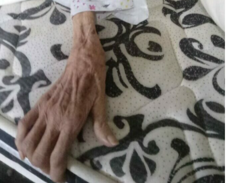 Mulher de 87 anos, que é cadeirante, era mantida sem alimentação ou condições de higiene em casa pelo próprio filho
