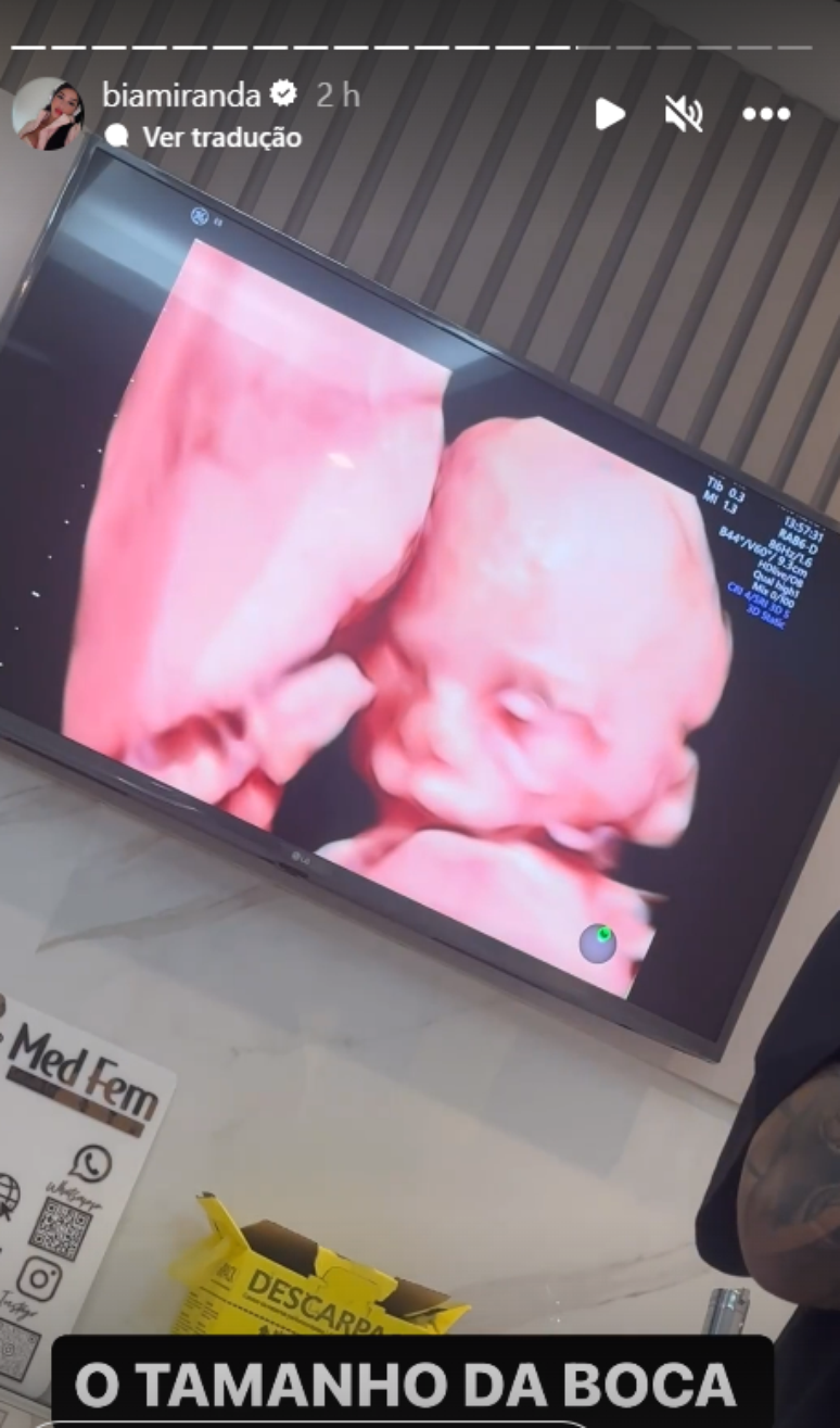 Pregnant, Bia Miranda enchants the web by showing her baby’s face in an ultrasound
