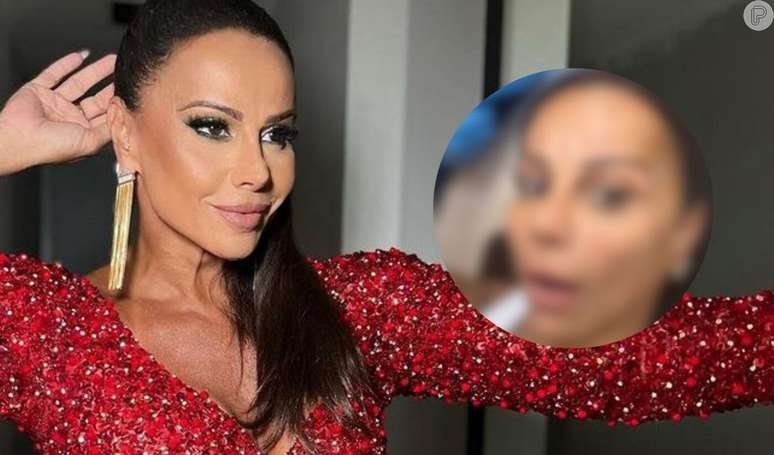 Viviane Araujo passa por procedimento no rosto e resultado impressiona.