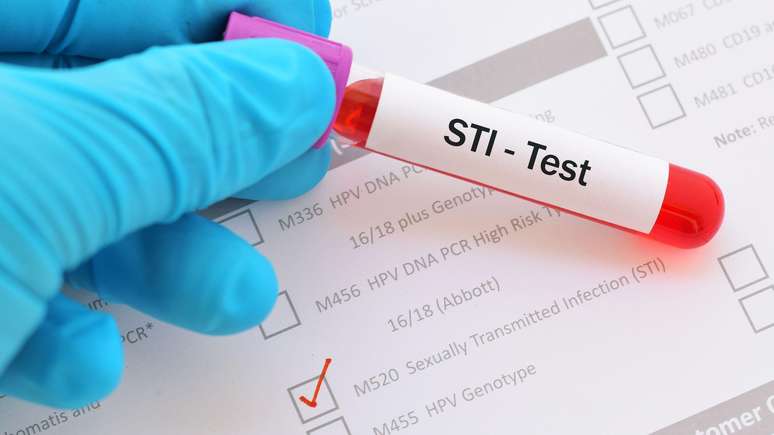 Se uma pessoa tiver sintomas de IST, é fundamental buscar ajuda médica imediatamente para passar por exames e começar tratamento