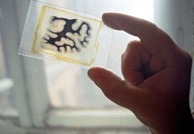 O cérebro de Lênin foi cortado em mais de 30.000 partes e estas foram colocadas em placas de vidro e algumas foram banhadas em corantes para estudo. Na década de 90, as amostras foram expostas à imprensa